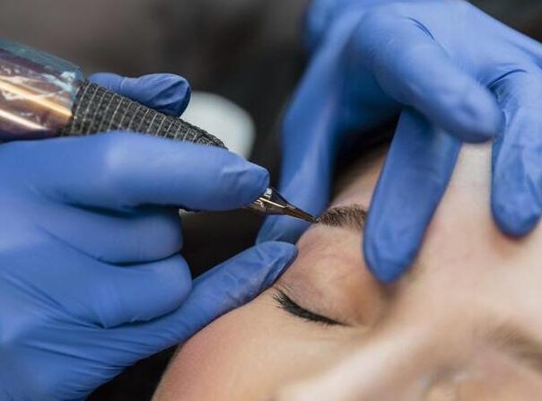 eliminar micropigmentación cejas con láser