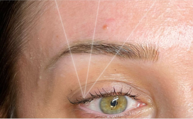 cuantas sesiones de laser se necesitas para eliminar el microblading