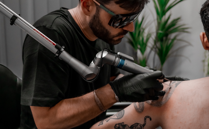 eliminacion de tatuajes con laser