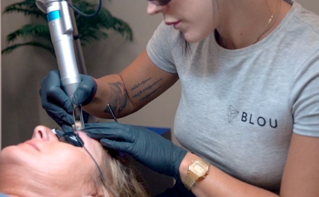 factores que influyen en la eliminación del microblading