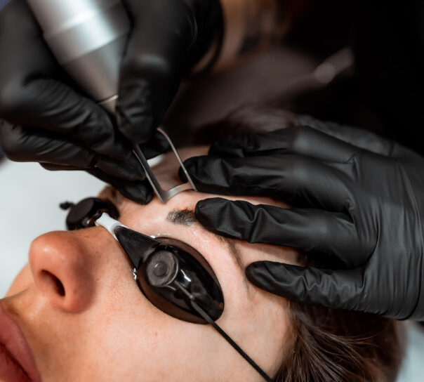 láser para quitar microblading precio