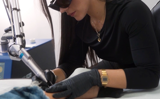eliminar tatuajes rapido