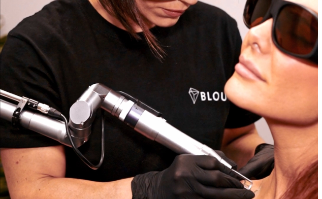 precio de sesiones de láser para quitar tatuajes blou tattoo removal