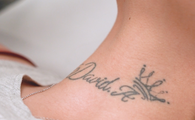 eliminar tatuaje cuello