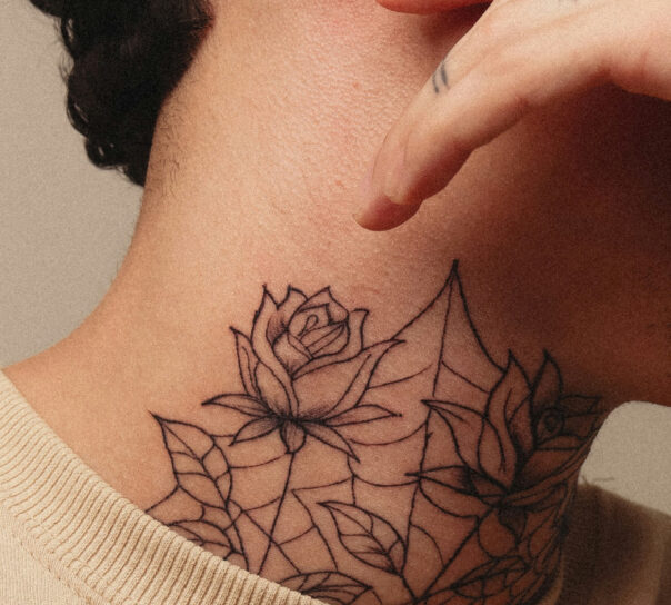 eliminacion de tatuajes en pieles sensibles