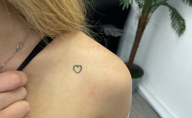 cuánto cuesta eliminar tatuajes pequeños