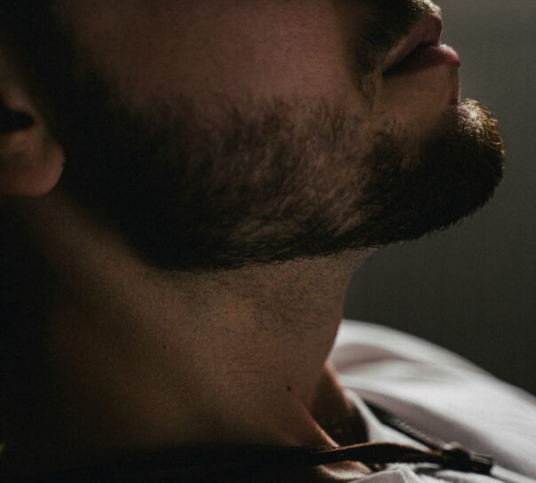 micropigmentación de barba: ¿se puede eliminar?