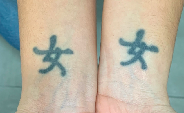 tatuajes mas eliminados en la actualidad: tatuajes por moda