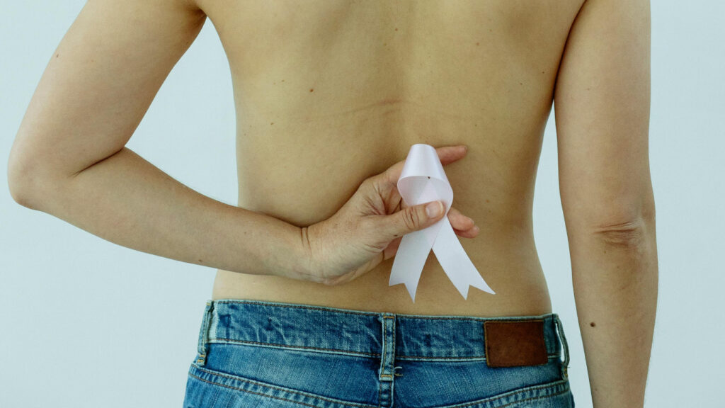 eliminación de tatuajes radioterapia