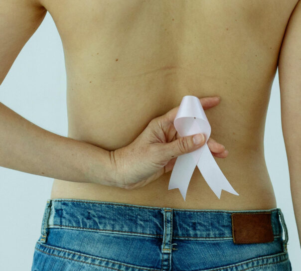 eliminación de tatuajes radioterapia