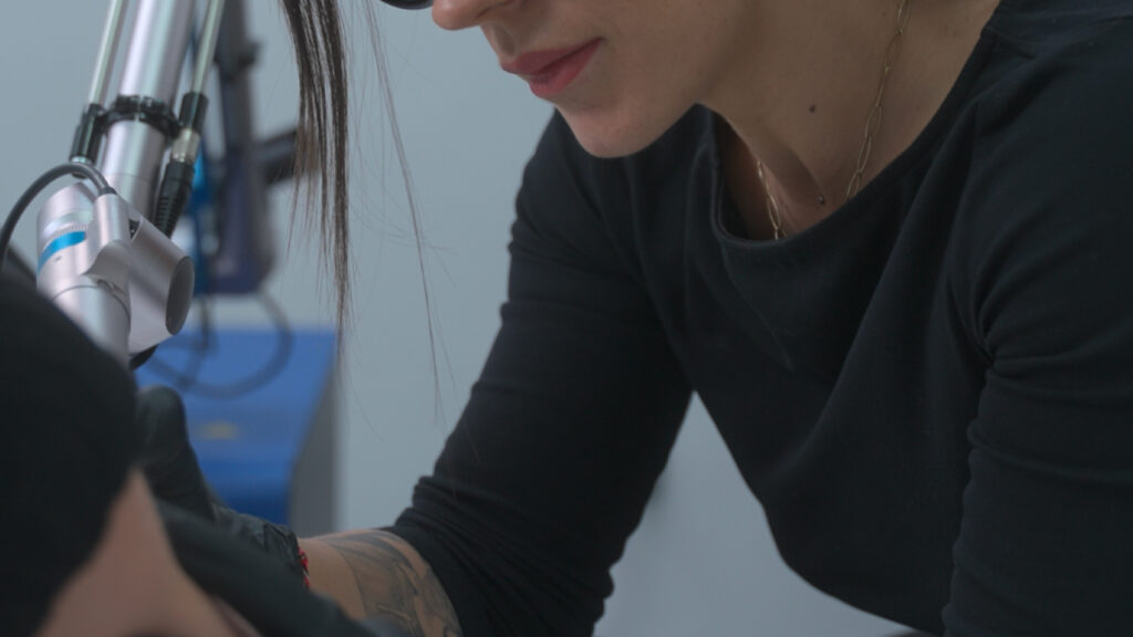 Cuánto vale quitarse un tatuaje