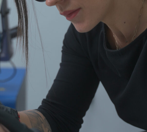 Cuánto vale quitarse un tatuaje