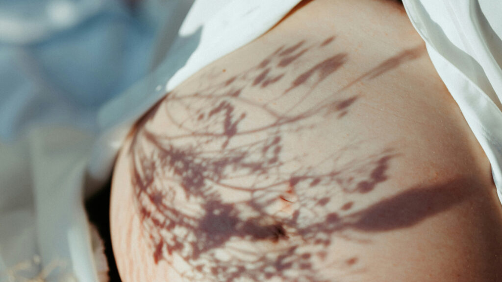 tatuaje lumbar y epidural dudas frecuentes