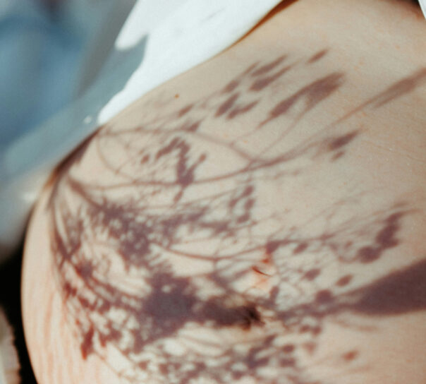 tatuaje lumbar y epidural dudas frecuentes