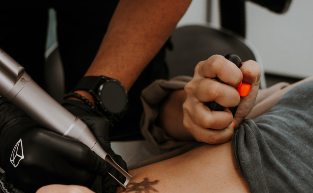 cicatriz al quitar un tatuaje