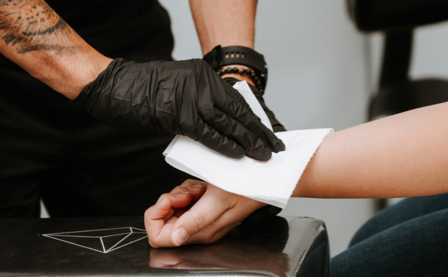 marcas al quitar un tatuaje