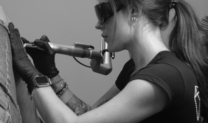 borrado de tatuajes black skin