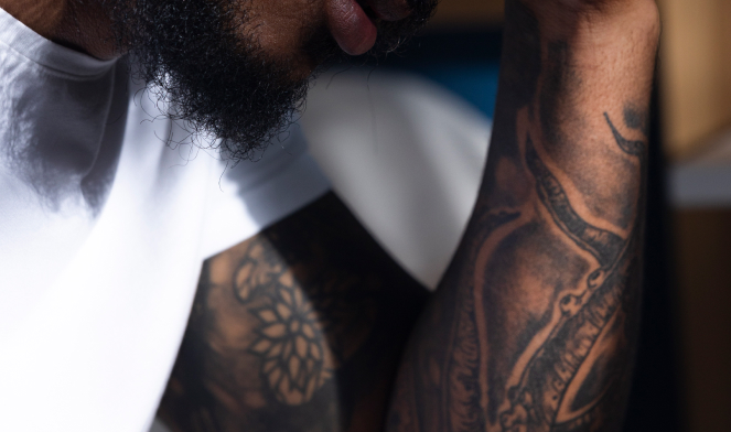 eliminar tatuajes en pieles oscuras