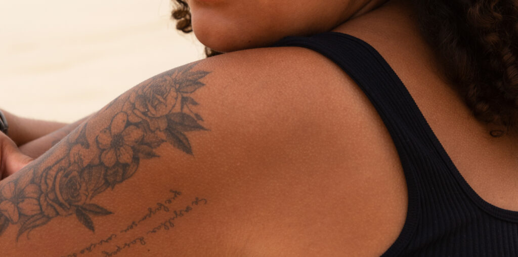 quitar tatuajes en pieles negras