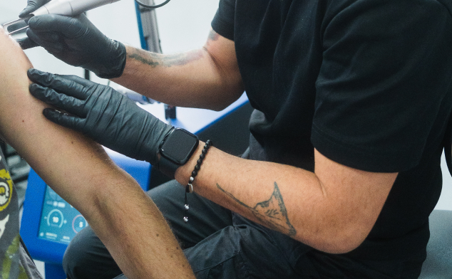 quitar tatuajes viejos