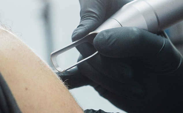 tatuaje queloide cicatriz