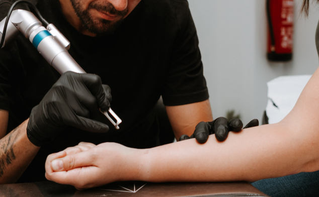 borrar tatuaje en la muñeca