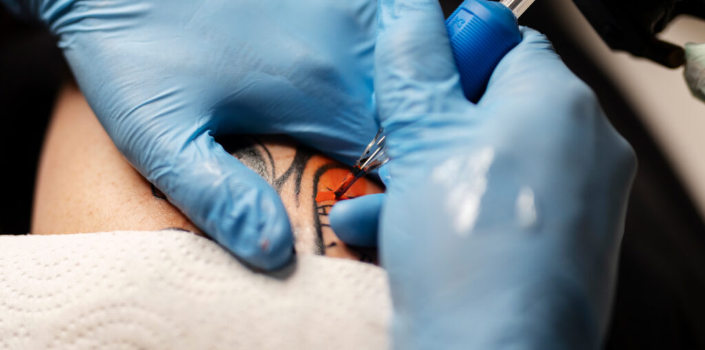 quitar tatuaje color rojo