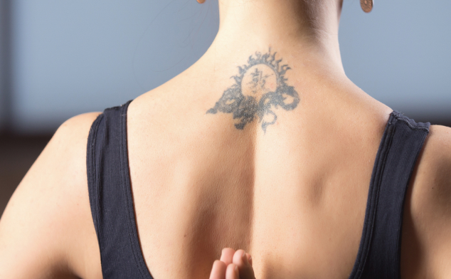 se puede atenuar un tatuaje
