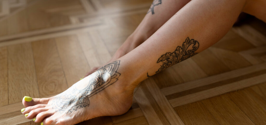 eliminar tatuaje en tobillo