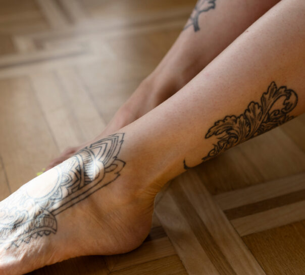eliminar tatuaje en tobillo