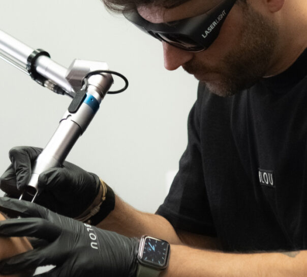 eliminación quirúrgica de tatuajes